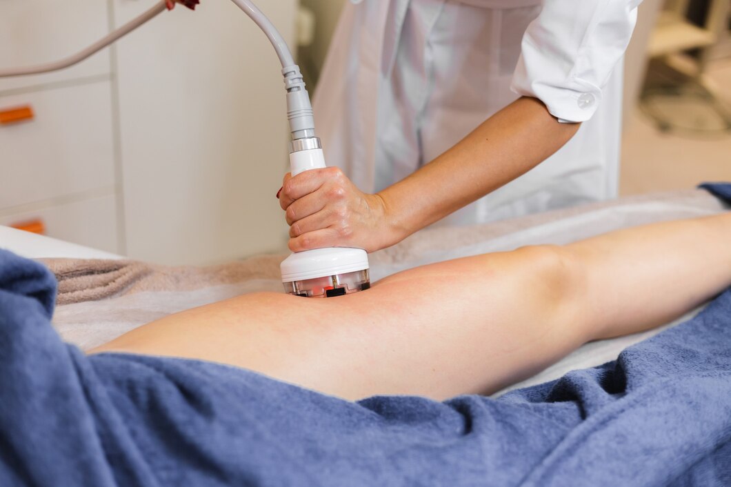 Fat cavitation and RF body contouring treatment